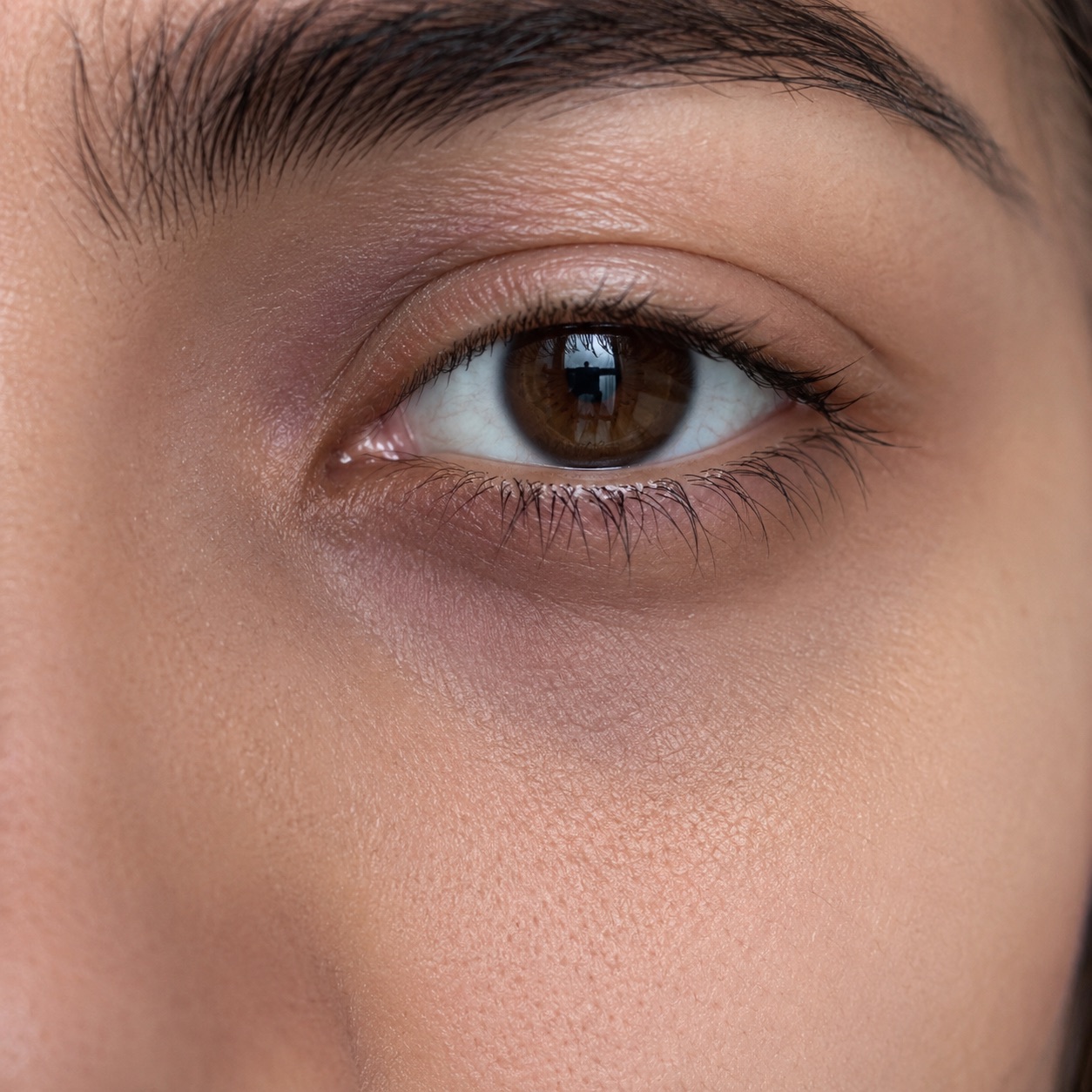 Ojeras